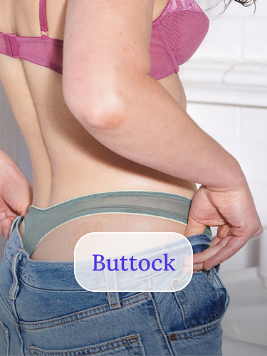 Buttock